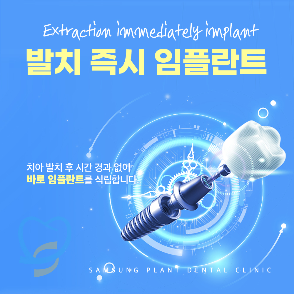 양천구임플란트
