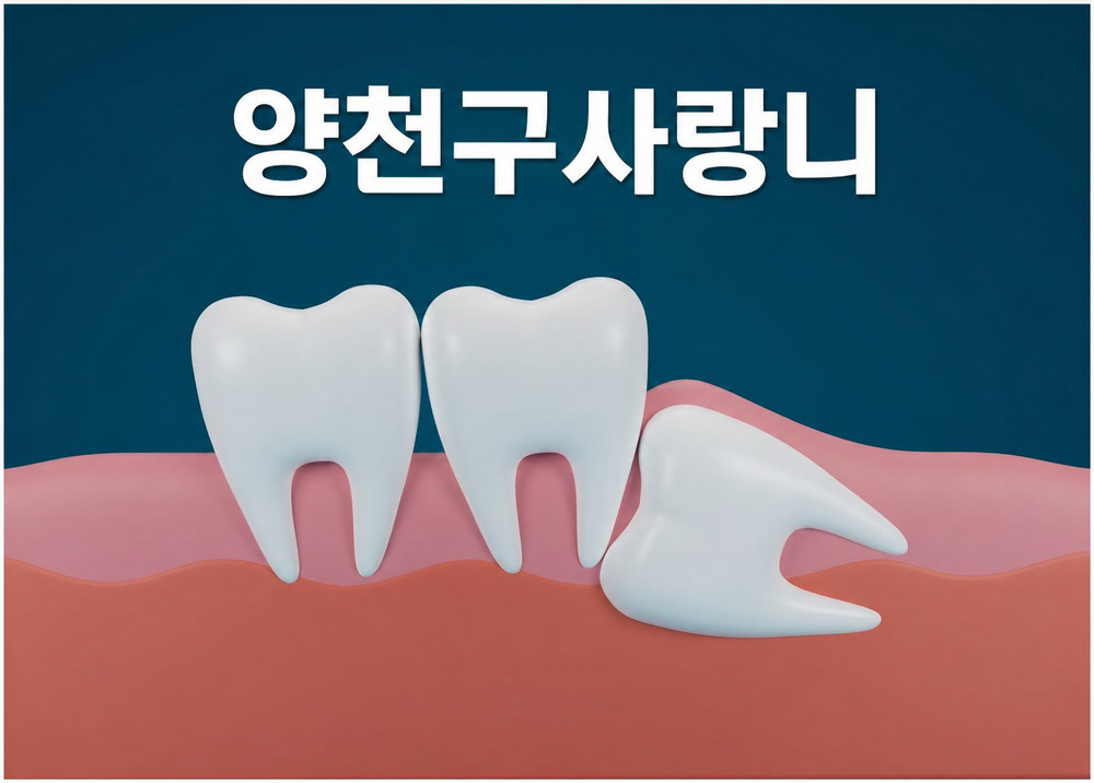 양천구사랑니 17세에서 25세 맹출 시기와 발치 상담 필요성 확인 방법 안내