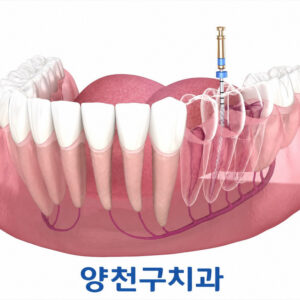 sinjeongnegeori-station-root-canal-1