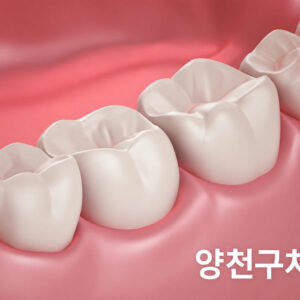 sinwol-dong-gum-treatment-1