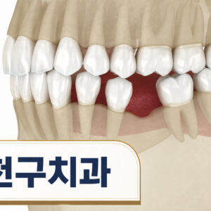 sinwol-dong-insurance-implant-1
