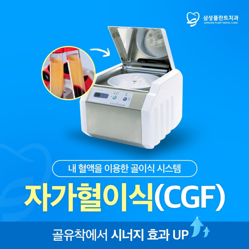자가혈 이식을 위해 환자 혈액을 채취하는 과정