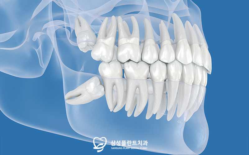 양천구치과상담