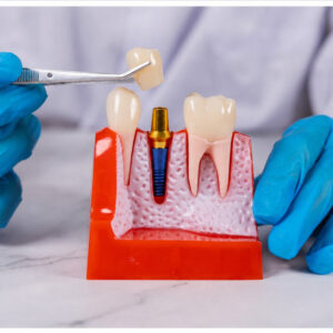 sinjeongnegeori-station-implant-1