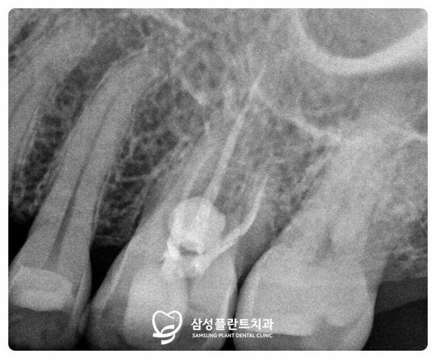 양천구치과가격상담
