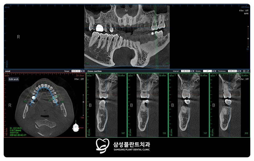양천구치과맞춤치료
