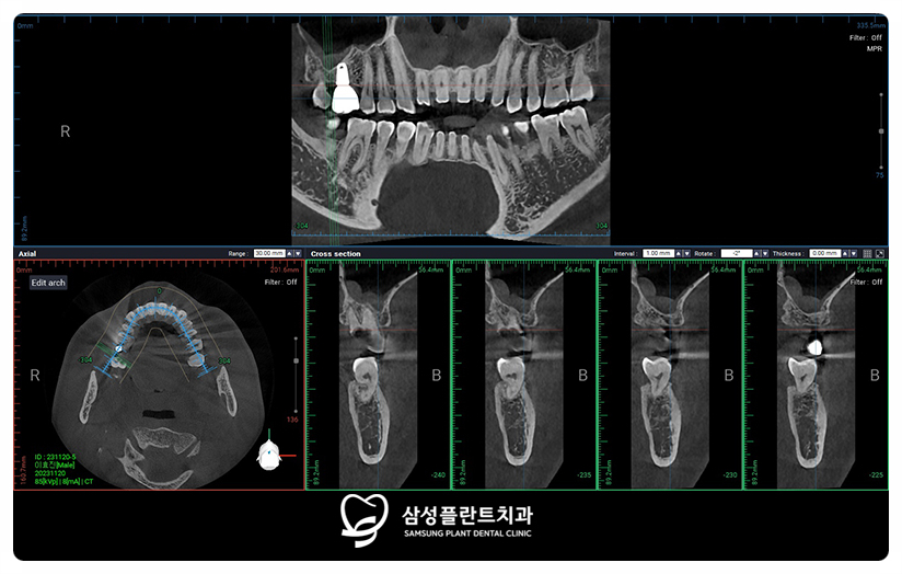 양천구치과정밀진단