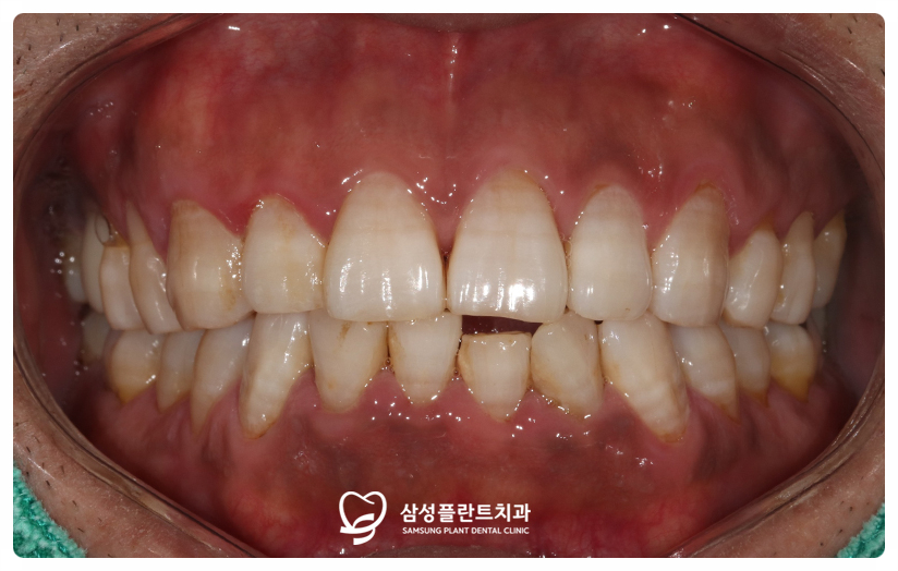 양천구치과치과추천