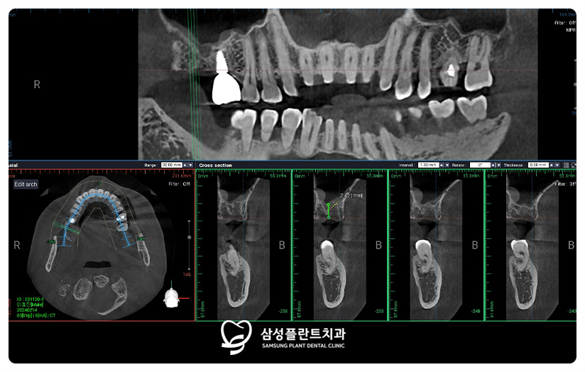 양천구치과후기정보